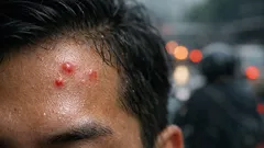 Jerawat di dahi: penyebab paling umum dan cara mengatasinya tanpa panik
